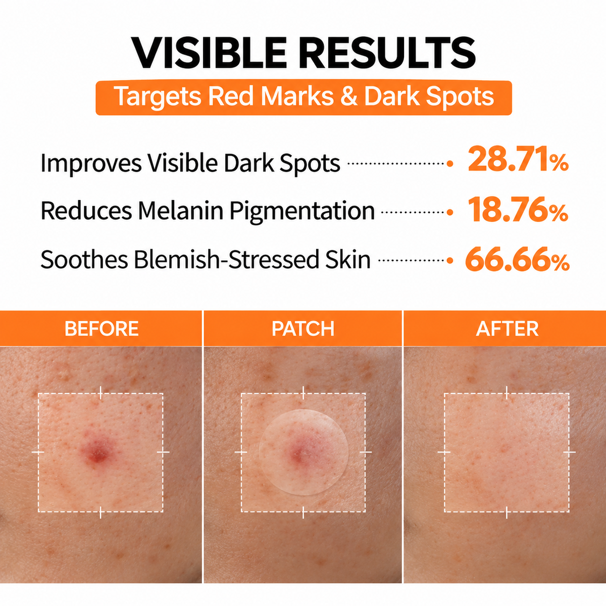 Microva Pimple Patch