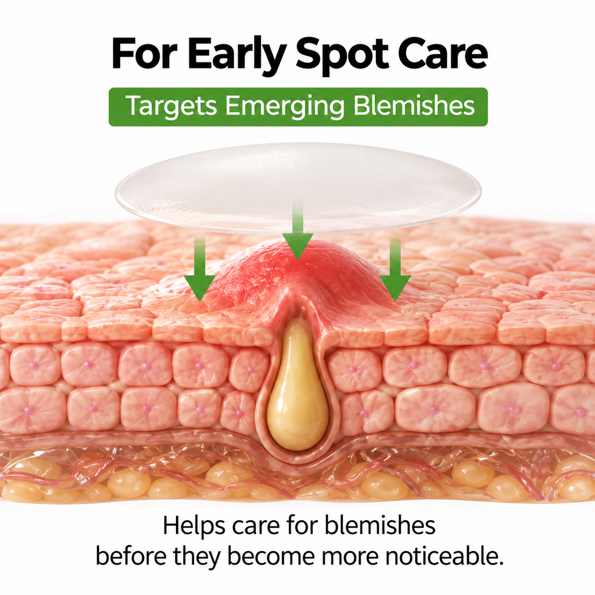 Microva Pimple Patch