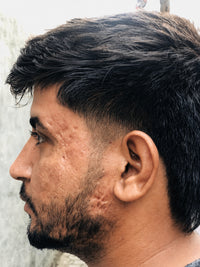 Vivek Malhotra