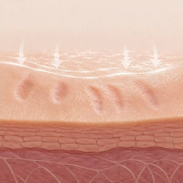 Scar edges blur