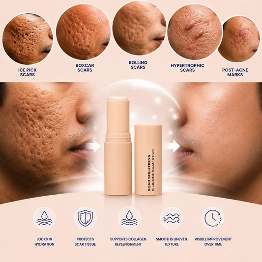 Acne Swipe Stick